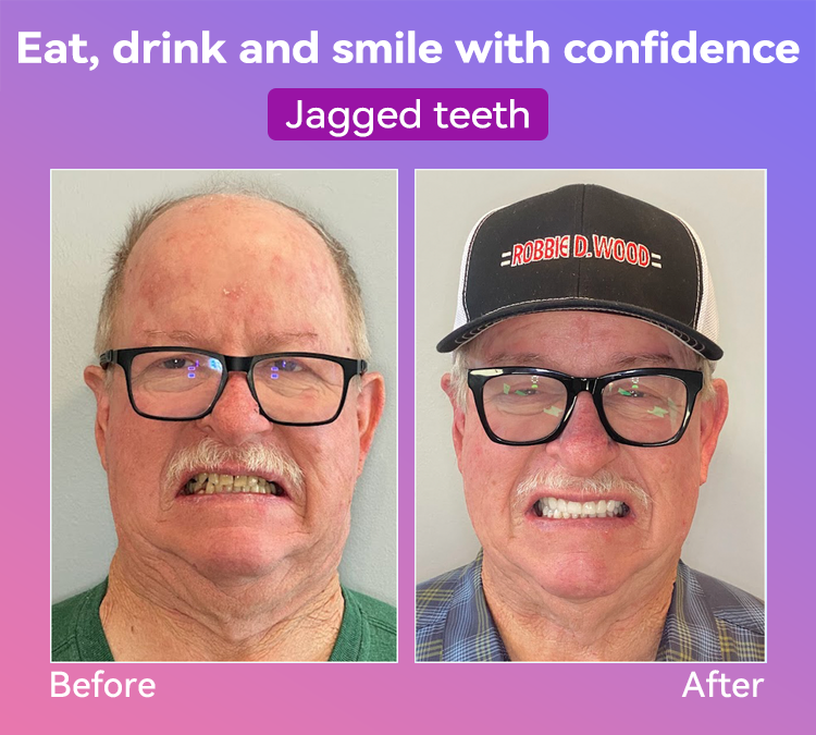 𝐉𝐚𝐬𝐬𝐞𝐞𝐦® Latest Premium Comfort Dentures💕 (High-End Dentures, Easy to Wear - Limited Time 70% Discount)🔥