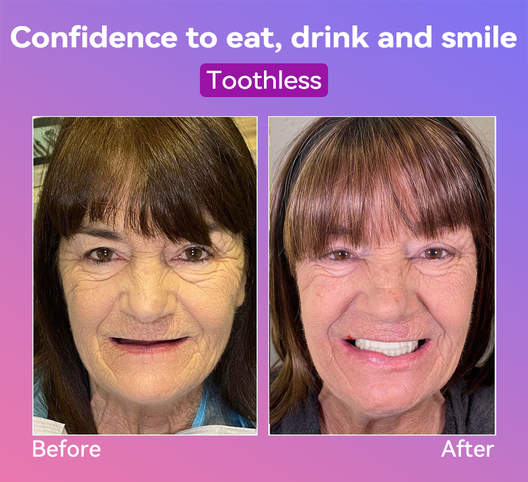 𝐉𝐚𝐬𝐬𝐞𝐞𝐦® Latest Premium Comfort Dentures💕 (High-End Dentures, Easy to Wear - Limited Time 70% Discount)🔥