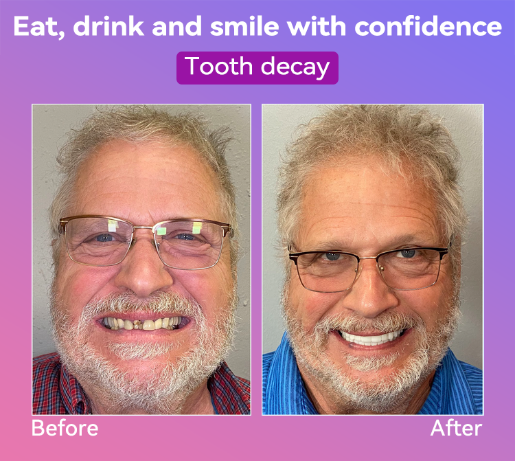 𝐉𝐚𝐬𝐬𝐞𝐞𝐦® Latest Premium Comfort Dentures💕 (High-End Dentures, Easy to Wear - Limited Time 70% Discount)🔥