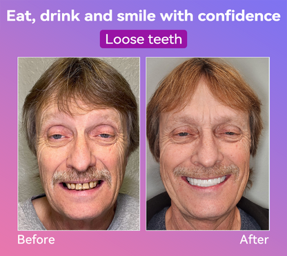 𝐉𝐚𝐬𝐬𝐞𝐞𝐦® Latest Premium Comfort Dentures👩‍⚕️🎉 (High-End Dentures, Easy to Wear - Limited Time 70% Discount)