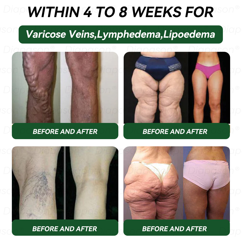 𝑶𝒇𝒇𝒊𝒄𝒊𝒂𝒍 𝑺𝒕𝒐𝒓𝒆🍀 | 𝐃𝒊𝓪𝐩𝓪𝙨𝐨𝒏®Ｇ𝖫𝑃-𝟏 9 𝐼𝑁 1 𝐻𝑒𝑎𝑙𝑡ℎ 𝑆𝑜𝑙𝑢𝑡𝑖𝑜𝑛 𝐎𝑟𝑎𝑙 𝐿𝑖𝑞𝑢𝑖𝑑—— 𝐶ℎ𝑟𝑜𝑛𝑖𝑐 𝐷𝑖𝑠𝑒𝑎𝑠𝑒 𝑃𝑟𝑜𝑡𝑒𝑐𝑡𝑖𝑜𝑛 𝐹𝑜𝑟𝑚𝑢𝑙𝑎