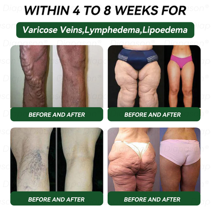 𝑶𝒇𝒇𝒊𝒄𝒊𝒂𝒍 𝑺𝒕𝒐𝒓𝒆🍀 | 𝐃𝒊𝓪𝐩𝓪𝙨𝐨𝒏®Ｇ𝖫𝑃-𝟏 9 𝐼𝑁 1 𝐻𝑒𝑎𝑙𝑡ℎ 𝑆𝑜𝑙𝑢𝑡𝑖𝑜𝑛 𝐎𝑟𝑎𝑙 𝐿𝑖𝑞𝑢𝑖𝑑—— 𝐶ℎ𝑟𝑜𝑛𝑖𝑐 𝐷𝑖𝑠𝑒𝑎𝑠𝑒 𝑃𝑟𝑜𝑡𝑒𝑐𝑡𝑖𝑜𝑛 𝐹𝑜𝑟𝑚𝑢𝑙𝑎