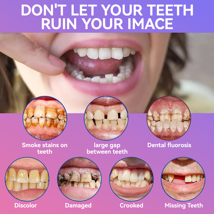 𝐉𝐚𝐬𝐬𝐞𝐞𝐦® Latest Premium Comfort Dentures👩‍⚕️🎉 (High-End Dentures, Easy to Wear - Limited Time 70% Discount)